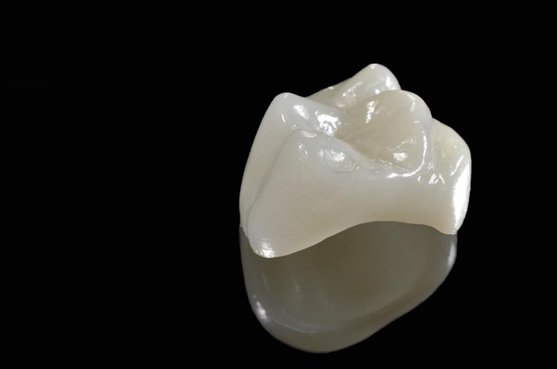 Porcelain Crowns North Bergen, NJ