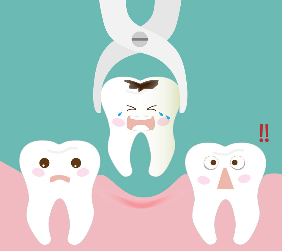 TOOTH EXTRACTION NORTH BERGEN NJ DENTIST