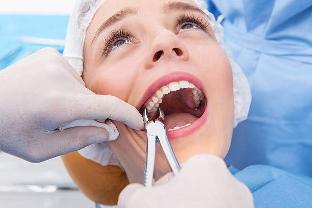 TOOTH EXTRACTION NORTH BERGEN NJ DENTIST