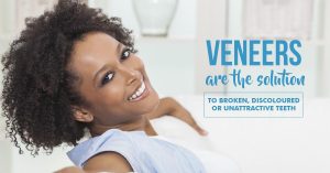 A Detailed Guide to Dental Veneers