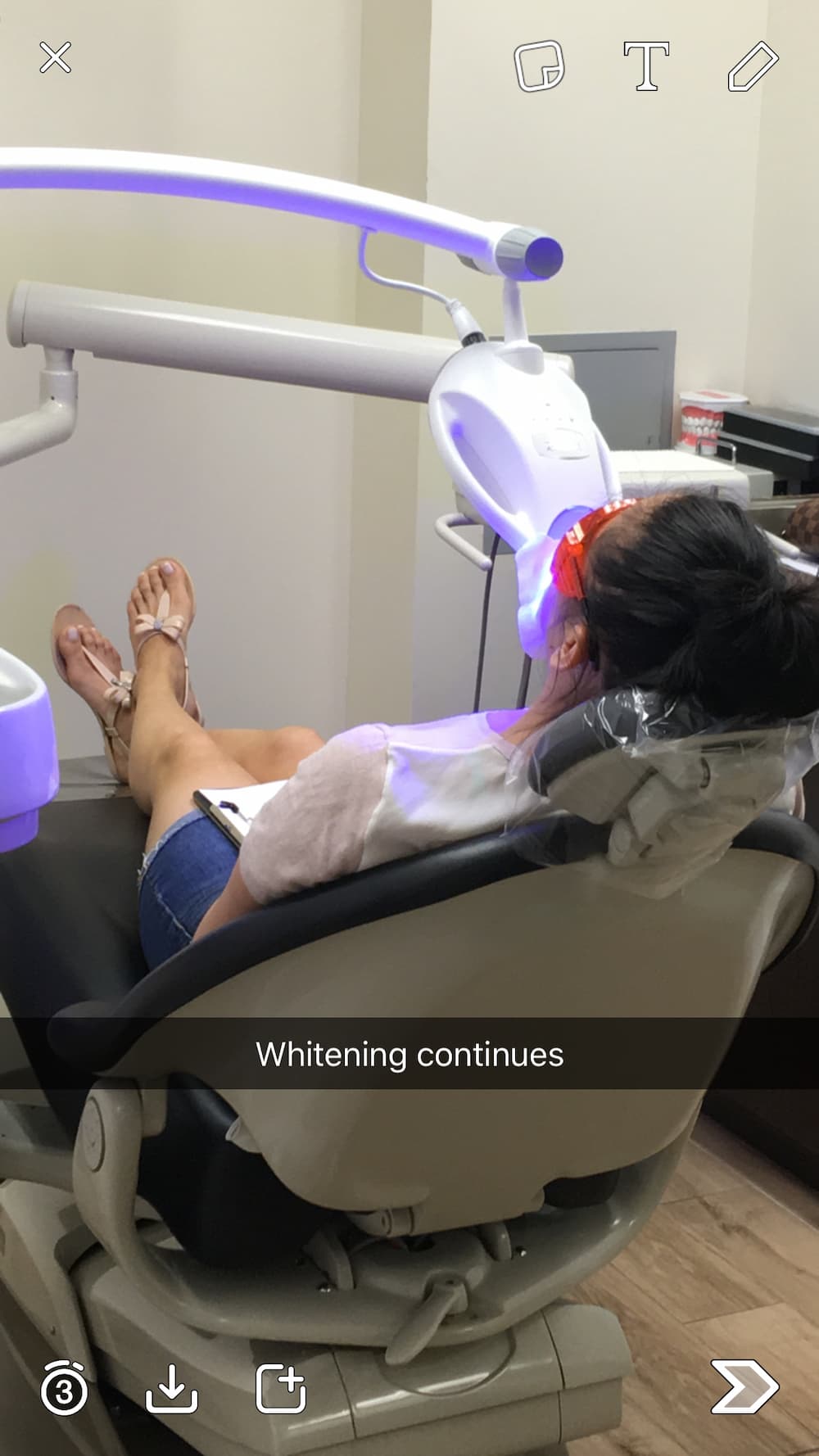Miss Long Island receiving professional Zoom teeth whitening treatment at Aesthetic Dental in North Bergen
