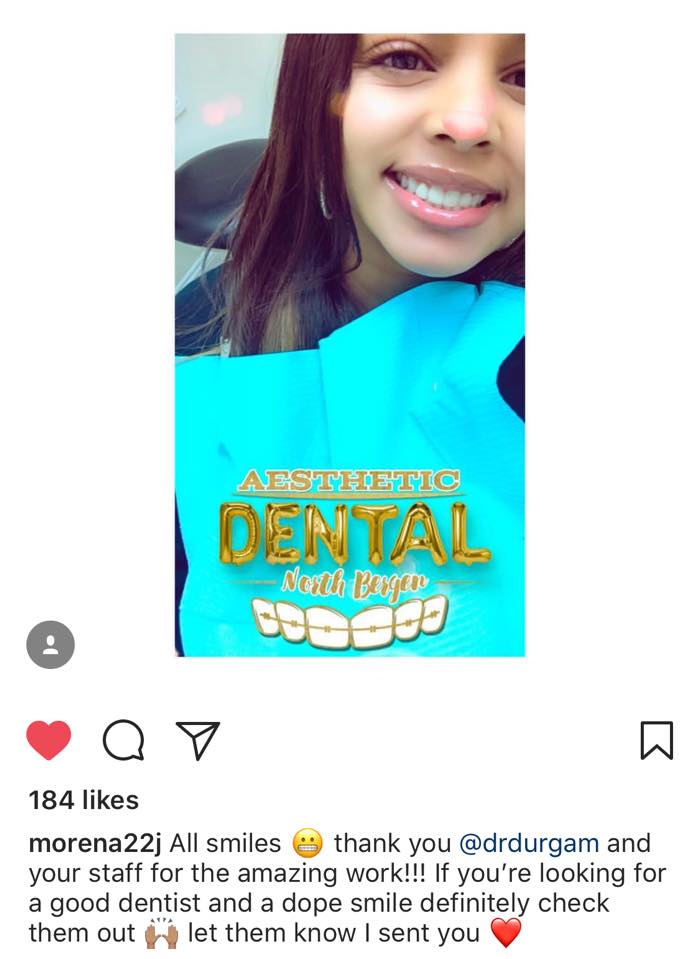 Whitening results