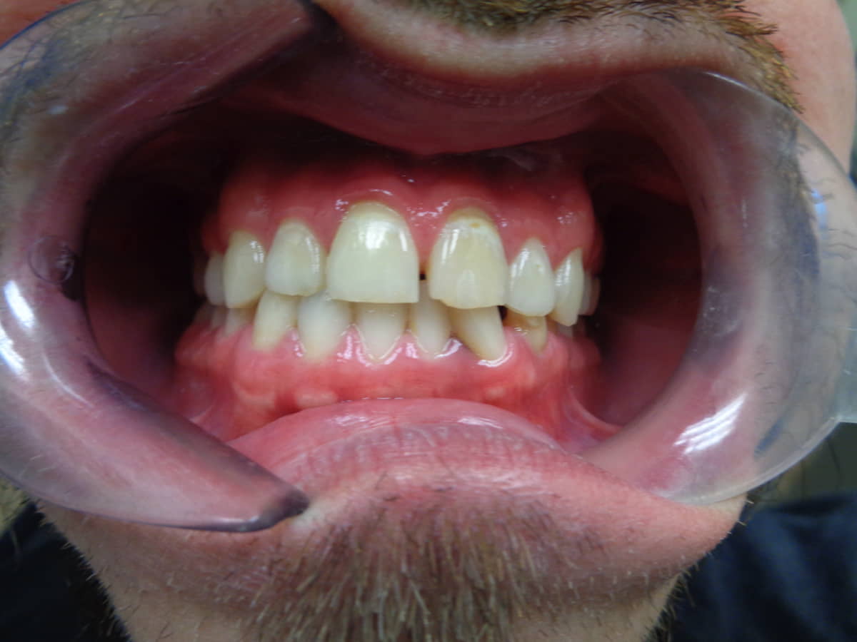 Breen before ortho